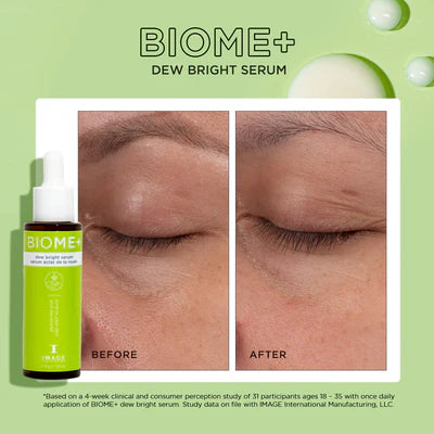 Image Skincare - Biome+ Dew Bright Serum