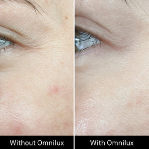 Omnilux Contour - FACE