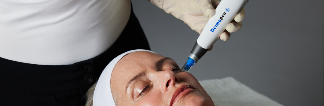 What you need to know about Microneedling with the Dermapen4