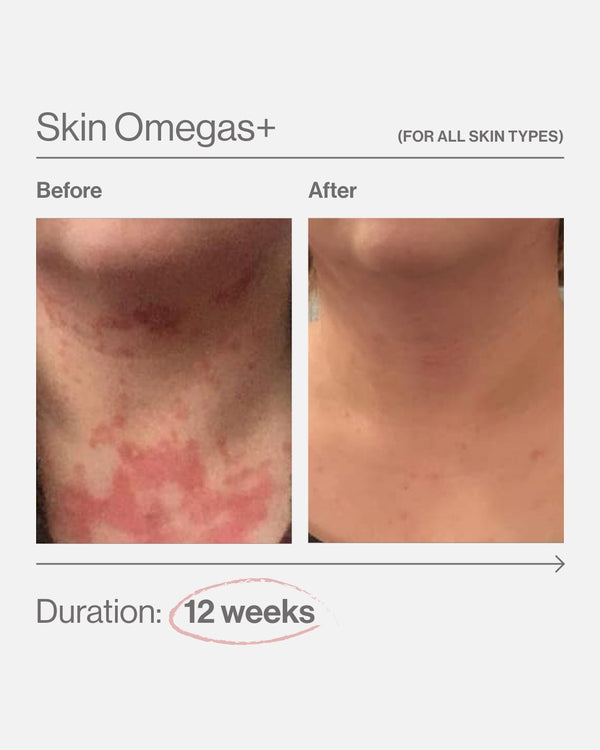 Skin Omegas+ 180