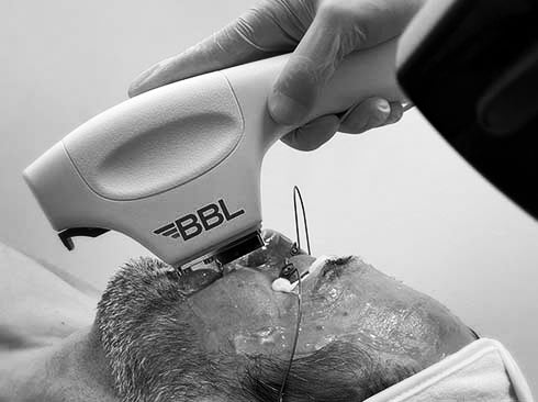 High tech treatment for men