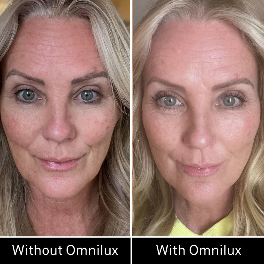 Omnilux Contour - FACE