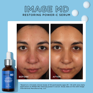 IMAGE MD® Restoring Power-C Serum (1oz)