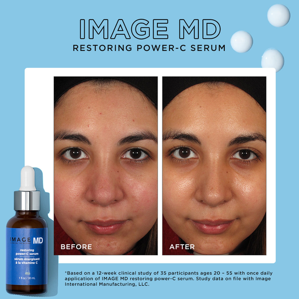 IMAGE MD® Restoring Power-C Serum (1oz)