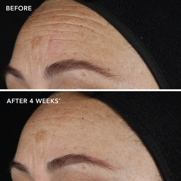 IMAGE Skincare AGELESS+ Retinol Pure Liquid Retinol 0.1% 3