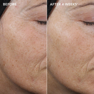 IMAGE Skincare AGELESS+ Retinol Pure Liquid Retinol 0.3% 2