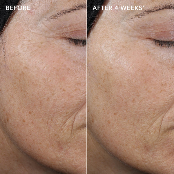 IMAGE Skincare AGELESS+ Retinol Pure Liquid Retinol 0.3% 2