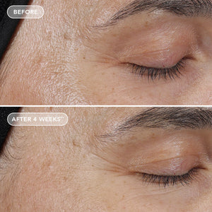 IMAGE Skincare AGELESS+ Retinol Pure Liquid Retinol 0.3% before & after