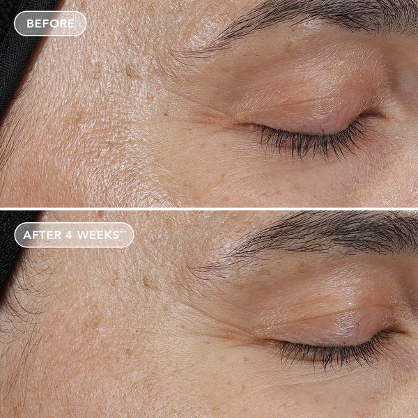 IMAGE Skincare AGELESS+ Retinol Pure Liquid Retinol 0.3% before & after