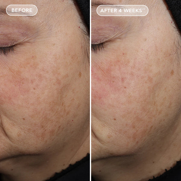 IMAGE Skincare AGELESS+ Retinol Pure Liquid Retinol 0.3% before & after 2