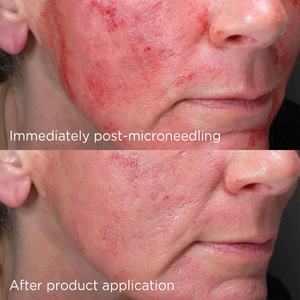 IMAGE Skincare DAILY PREVENTION Advanced Smartblend Mineral Moisturiser SPF50 2