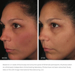 Image Ormedic Balancing Anti-Oxidant Serum