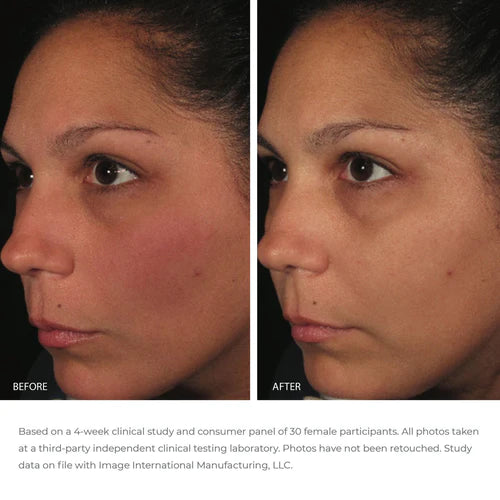 Image Ormedic Balancing Anti-Oxidant Serum