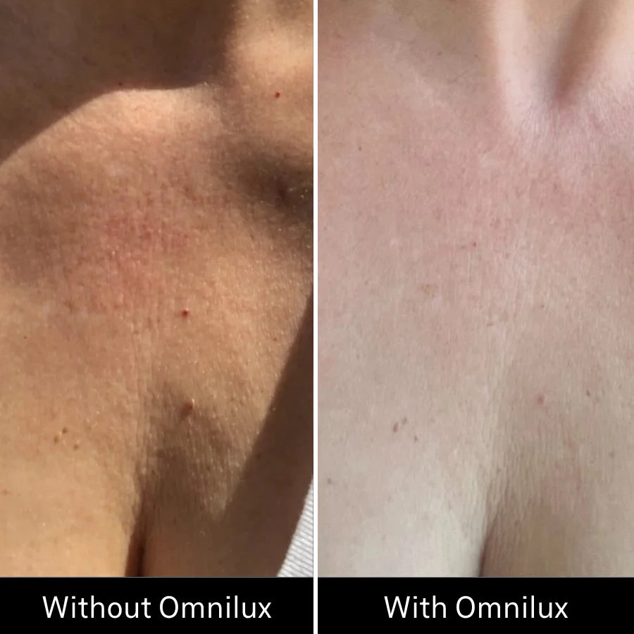 Omnilux Contour - NECK & DÉCOLLETÉ