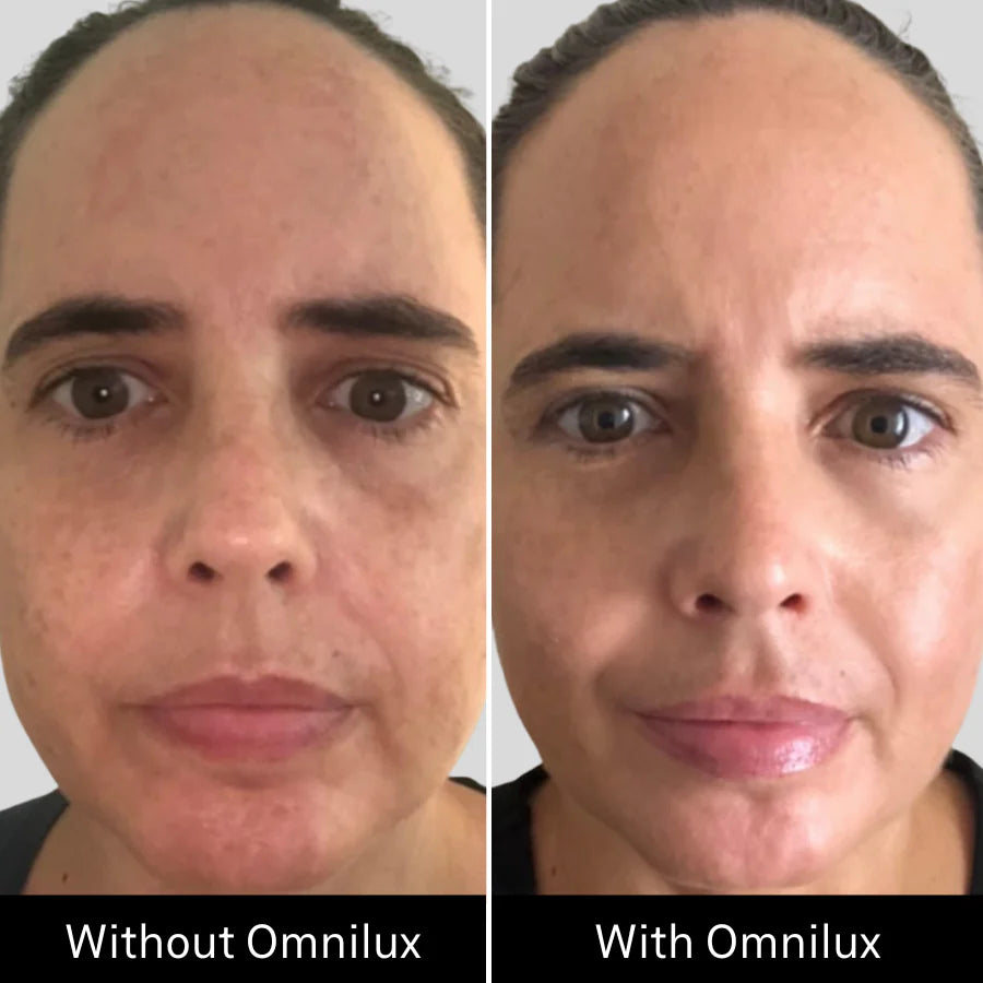 Omnilux Contour - FACE