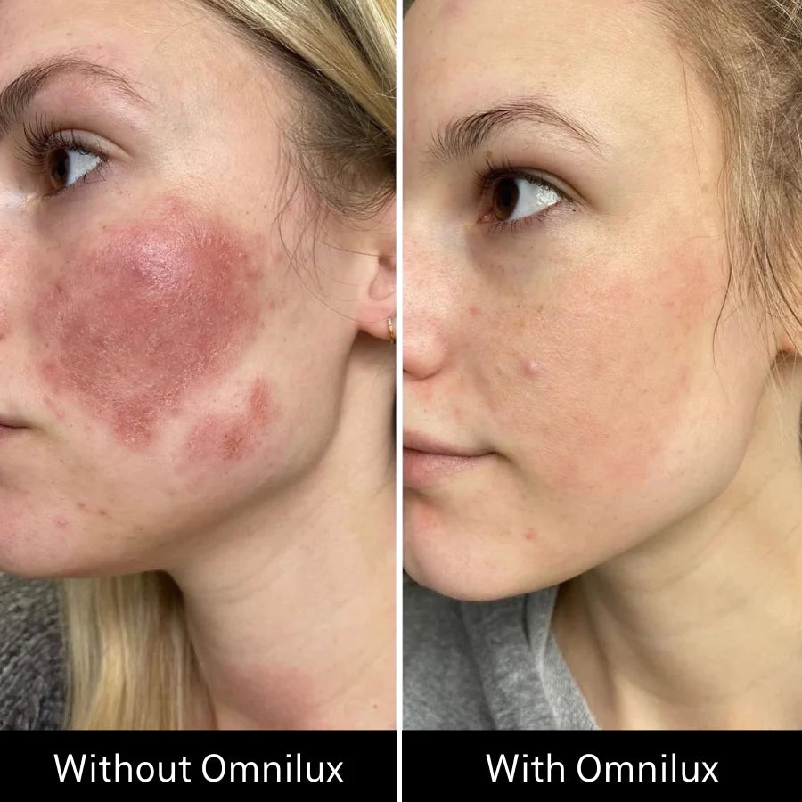 Omnilux Contour - FACE