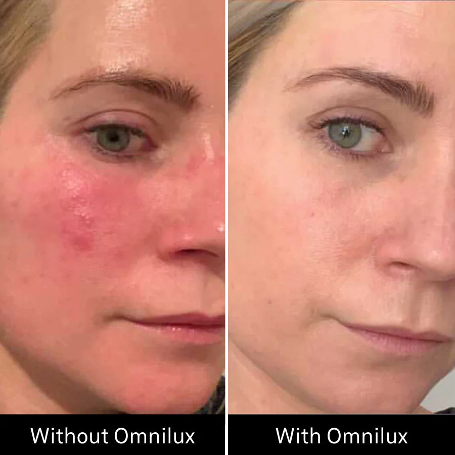 Omnilux Contour - FACE