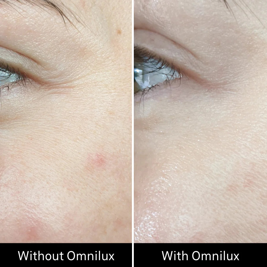 Omnilux Contour - FACE