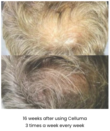Celluma Restore