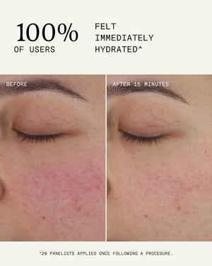 Ultraceuticals Ultra B² Recovery Cream