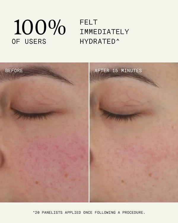 Ultraceuticals Ultra B² Recovery Cream