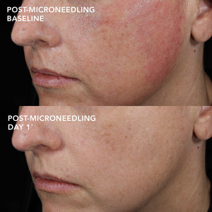IMAGE Skincare MD Barrier Repair Recovery Balm