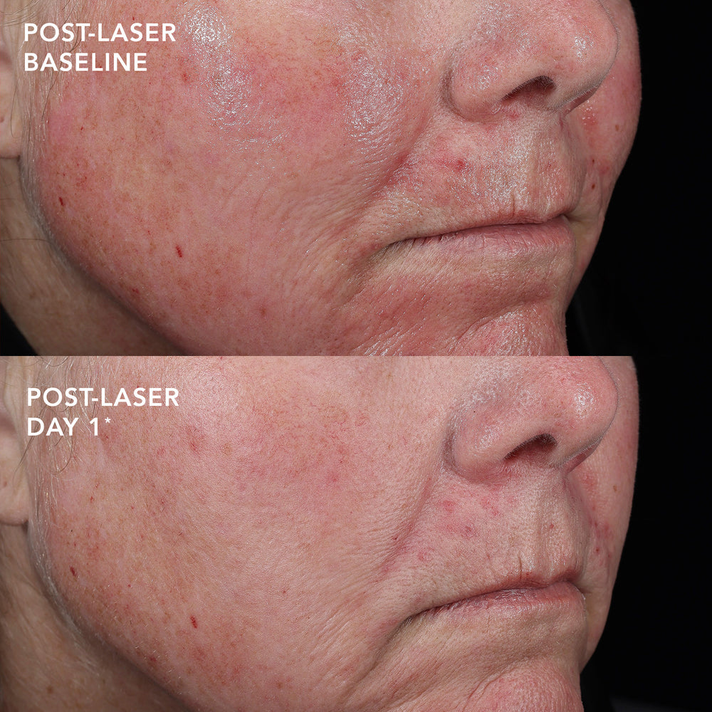 IMAGE Skincare MD Barrier Repair Recovery Balm 