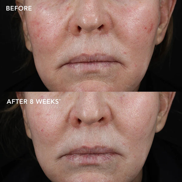IMAGE Skincare MD Biotech Longevity Creme