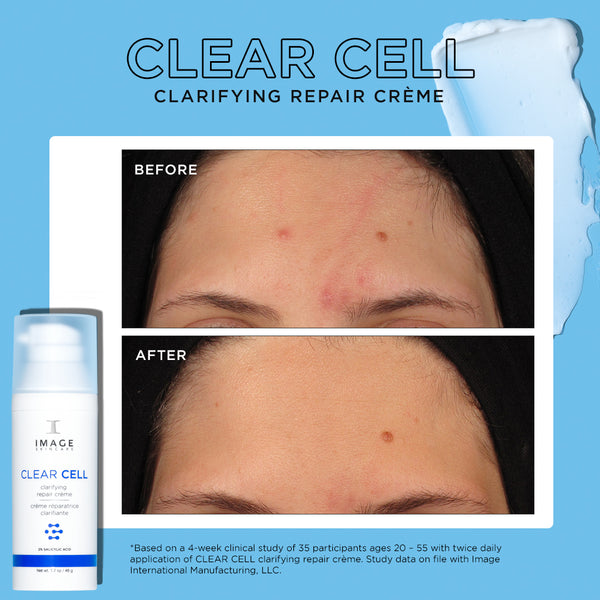 Image Skincare - Clear Cell - Clarifying Repair Creme (1.7oz)