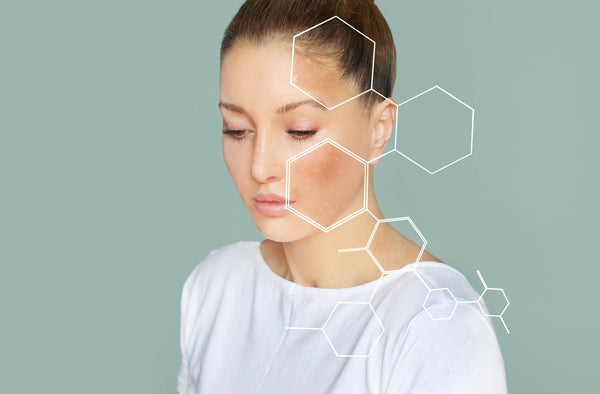Visia Skin Analysis