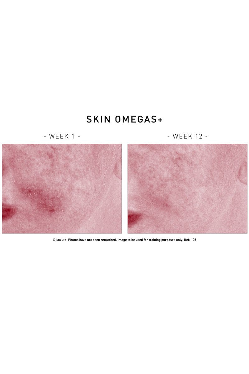 Skin Omegas+ 180