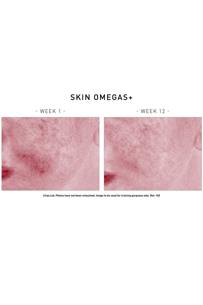 Skin Omegas+ 180